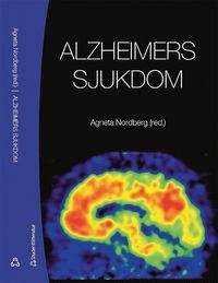 Alzheimers sjukdom; Agneta Nordberg; 2013