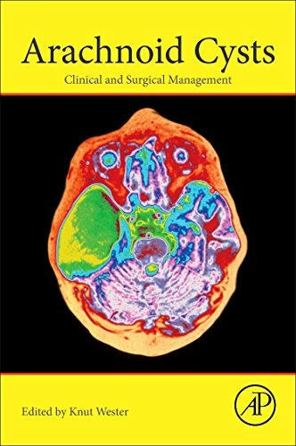 Arachnoid cysts - clinical and surgical management; Knut Wester; 2017