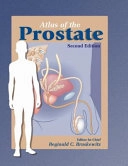 Atlas of the prostate; Reginald C. Bruskewitz; 2003