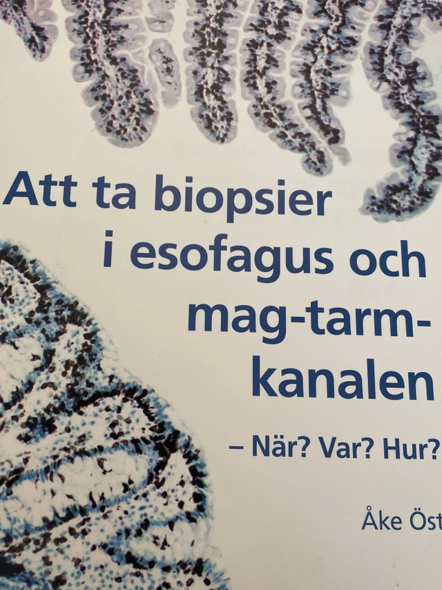 Att ta biopsier i esofagus och mag-tarm-kanalen : när? var? hur?; Åke Öst; 2012