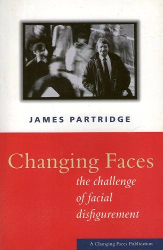Changing Faces: The Challenge of Facial Disfigurement; James Partridge; 1812