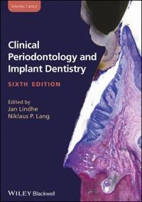 Clinical Periodontology and Implant Dentistry 2 Volume Set; Jan Lindhe Niklaus P. Lang; 2015