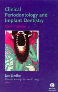 Clinical periodontology and implant dentistry; Thorkild Karring, Niklaus Peter Lang, Jan Lindhe; 2003