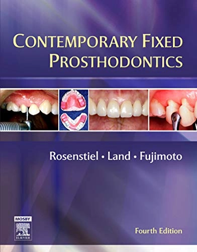 Contemporary fixed prosthodontics; Stephen F. Rosenstiel; 2006