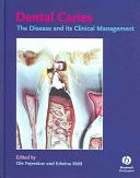 Dental caries : the disease and its clinical management; Ole Fejerskov, Edwina A. M. Kidd; 2003