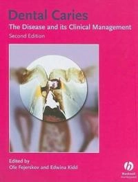 Dental Caries: The Disease and Its Clinical Management; Editor:Ole Fejerskov, Editor:Edwina Kidd; 2008