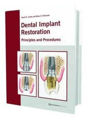Dental implant restoration : principles and procedures; Stuart H. Jacobs; 2011