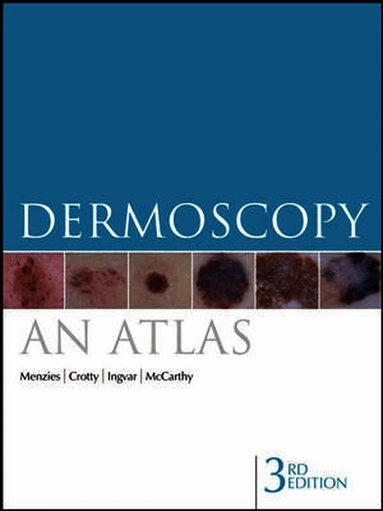 Dermoscopy; Scott Menzies, Kerry Crotty, Christian Ingvar, William McCarthy; 2009