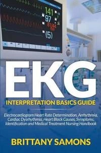 EKG Interpretation Basics Guide; Brittany Samons; 2015