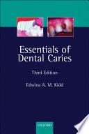 Essentials of dental caries : the disease and its management; Edwina A. M. Kidd; 2005