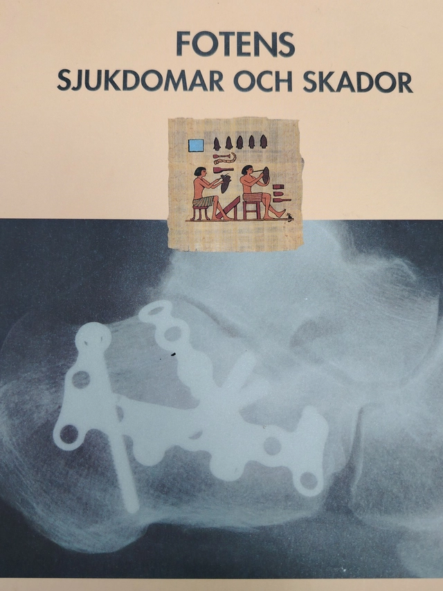 Fotens sjukdomar och skador; Jon Karlsson; 1998