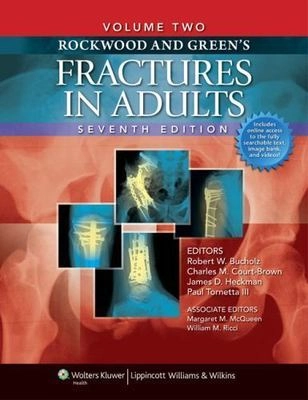 Fractures in adulta; Robert W Bucholz; 2020