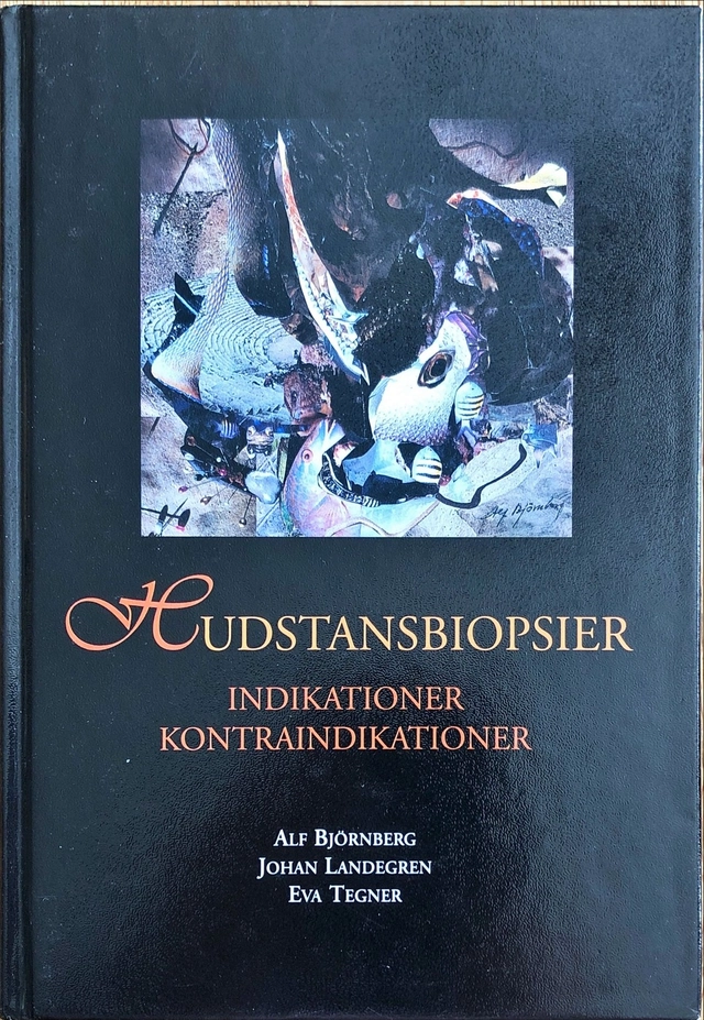 Hudstansbiopsier : indikationer, kontraindikationer; Alf Björnberg; 1998