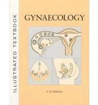 Illustrated textbook of gynaecology; Victor Ronald Tindall; 1991