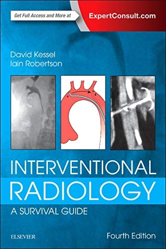 Interventional Radiology: A Survival Guide; David Kessel, Iain Robertson; 2016