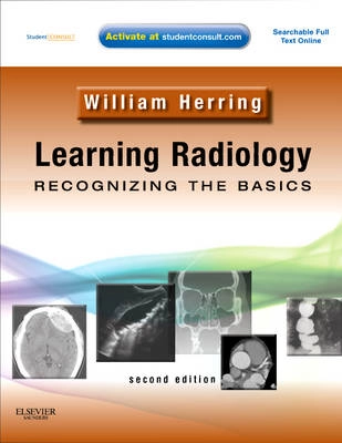Learning radiology : recognizing the basics; William. Herring; 2012