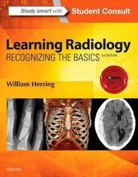 Learning radiology : recognizing the basics; William Herring; 2016