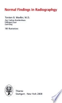 Normal findings in radiography; Torsten B. Möller; 2000