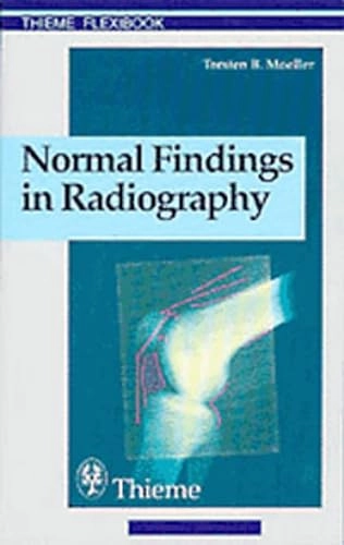 Normal findings in radiography; Torsten B. Möller; 2000