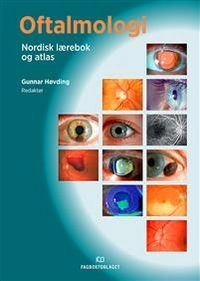 Oftalmologi : nordisk lærebok og atlas; Gunnar. Høvding; 2016