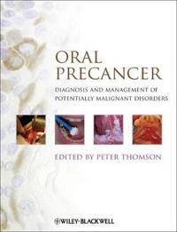 Oral Precancer: Diagnosis and Management of Potentially Malignant Disorders; Peter Thomson; 2012