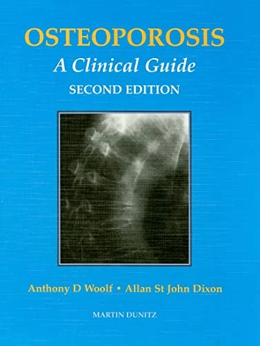 Osteoporosis : a clinical guide; Anthony D. Woolf; 1995