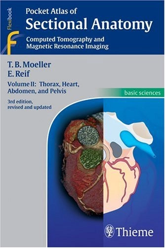 Pocket atlas of sectional anatomy : computed tomography and magnetic resonance imaging; Torsten B. Möller; 2007