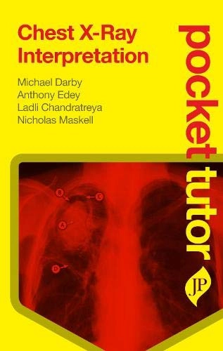 Pocket Tutor Chest X-Ray Interpretation; Darby Michael; 2012