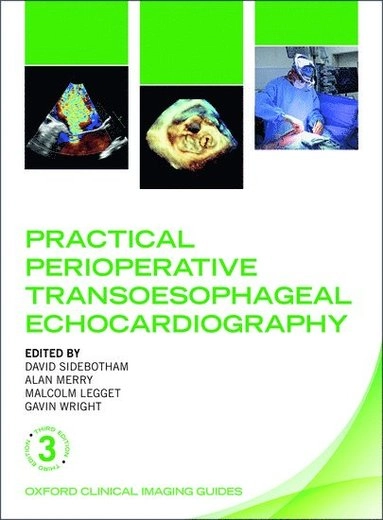 Practical Perioperative Transesophageal Echocardiography [Elektronisk resurs]; David Sidebotham, Alan Forbes Merry, Malcolm E Legget, I Gavin Wright; 2018