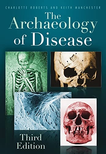 The archaeology of disease; Charlotte A. Roberts; 2012