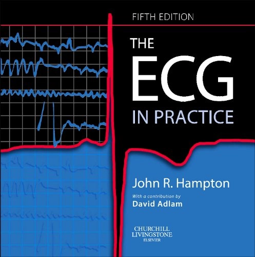 The ECG in practice; John R. Hampton; 2008