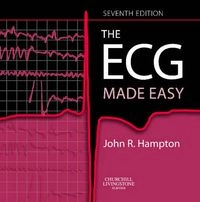 The ECG made easy; John R. Hampton; 2008