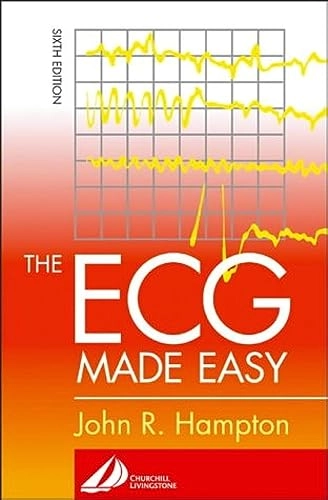 The ECG made easy; John R. Hampton; 2003