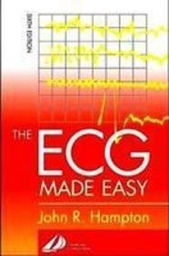 The ECG made easy; John R. Hampton; 2003
