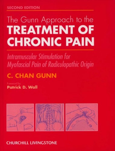 The Gunn approach to the treatment of chronic pain : intramuscular stimulation for myofascial pain of radiculopathic origin; C. Chan Gunn; 1996