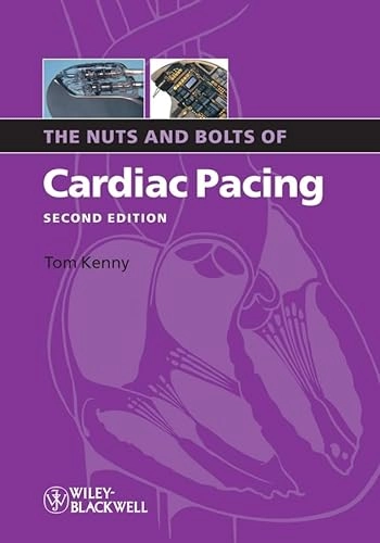 The Nuts and Bolts of Cardiac Pacing; Tom Kenny; 2005