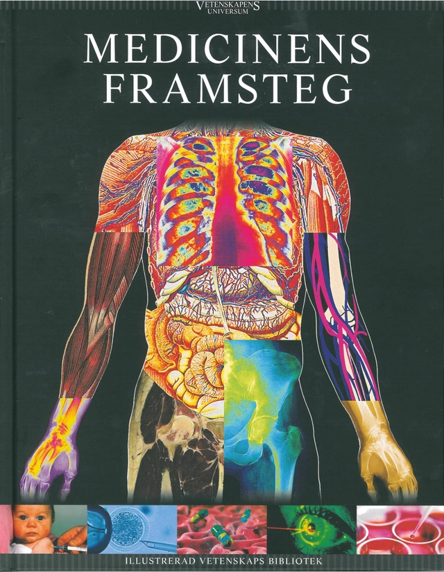 Vetenskapens universum. Medicinens framsteg; Jacob Christiansen, Anders Enevold, Lasse Foghsgaard, Anne Hansen, Gorm Palmgren, Stine Stentoft; 2009