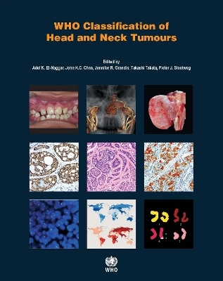 WHO classification of head and neck tumours; Adel K. El-Naggar; 2017
